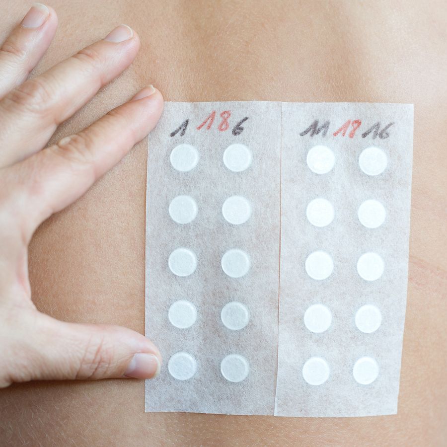 Allergien Unverträglichkeiten Die Techniker - 